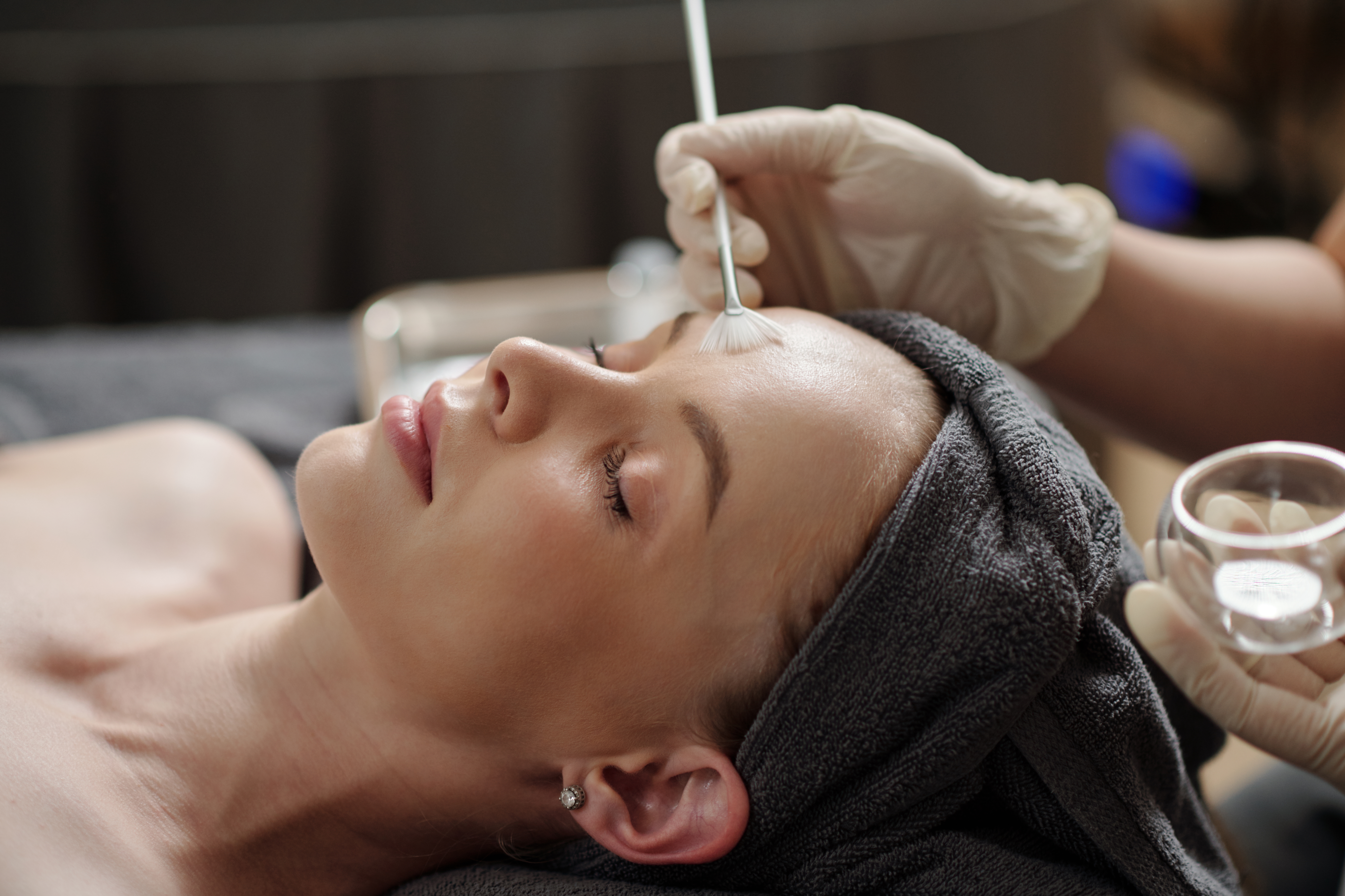 Chemical Peel